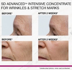 Strivectin SD Advanced Intensive Concentrate 135ml - Silnie działający krem przeciw zmarszczkom i rozstępom